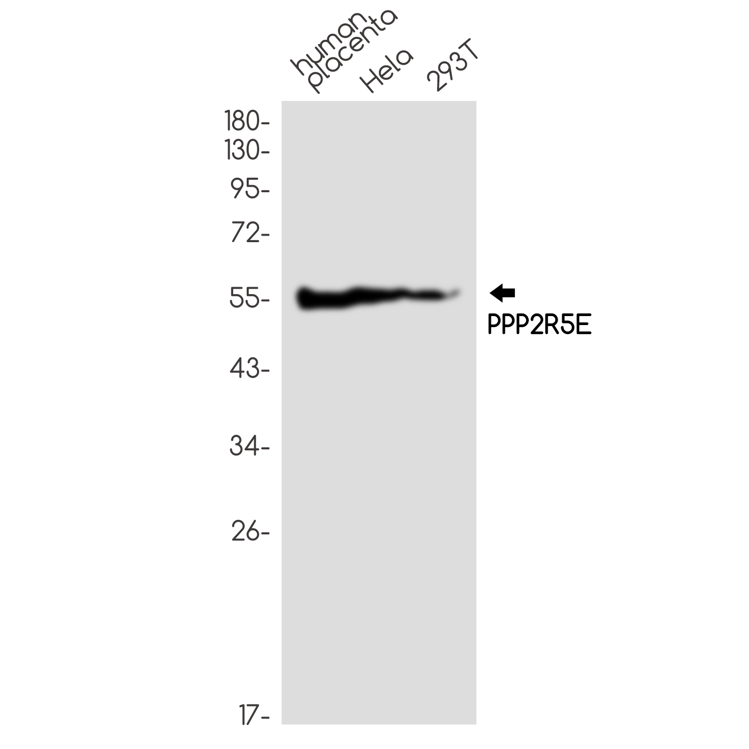 PPP2R5E Rabbit mAb ABZ2073