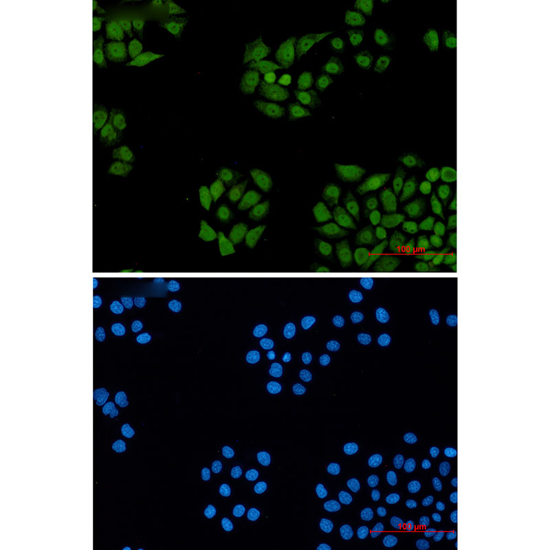 DDB1 Rabbit mAb ABZ2075