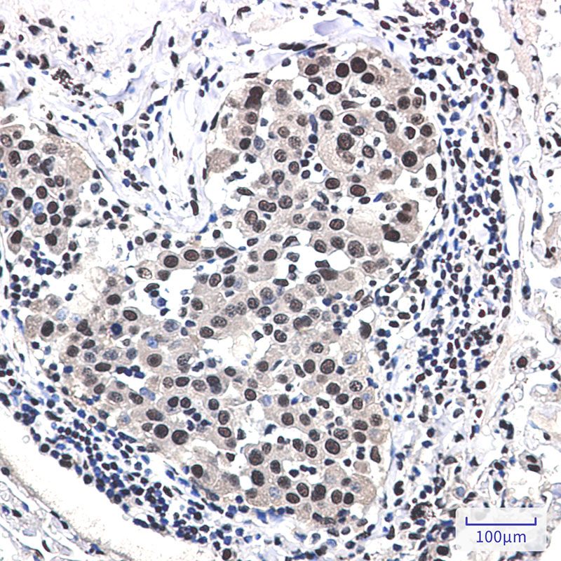 DDB1 Rabbit mAb ABZ2075