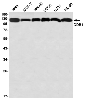 DDB1 Rabbit mAb ABZ2075