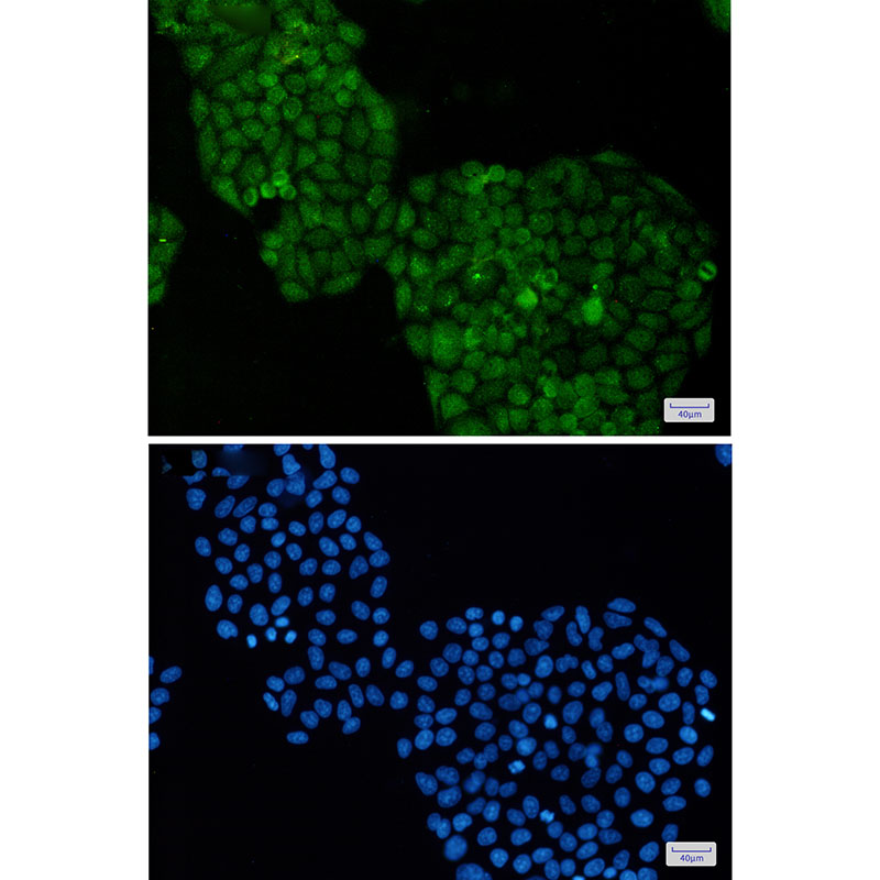 ADRM1/ARM-1 Rabbit mAb ABZ2077