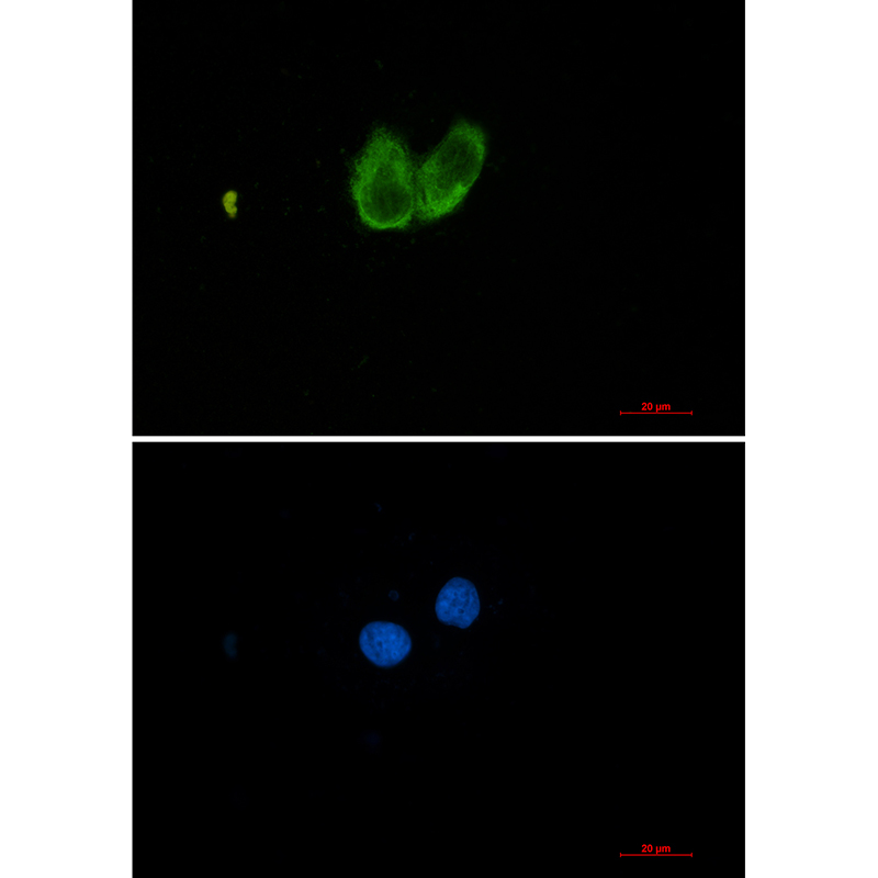 ZYX Rabbit mAb ABZ2079