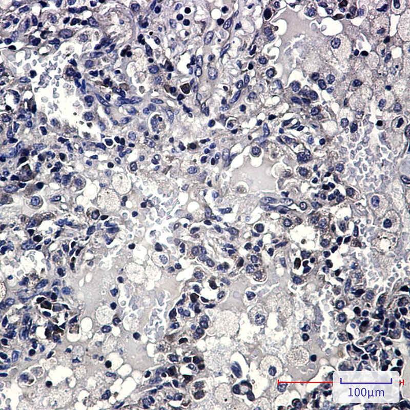 ZYX Rabbit mAb ABZ2079