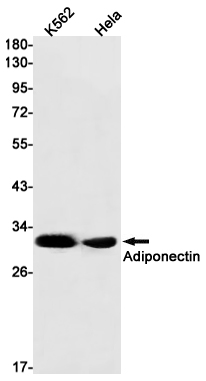 Adiponectin Rabbit mAb ABZ2081