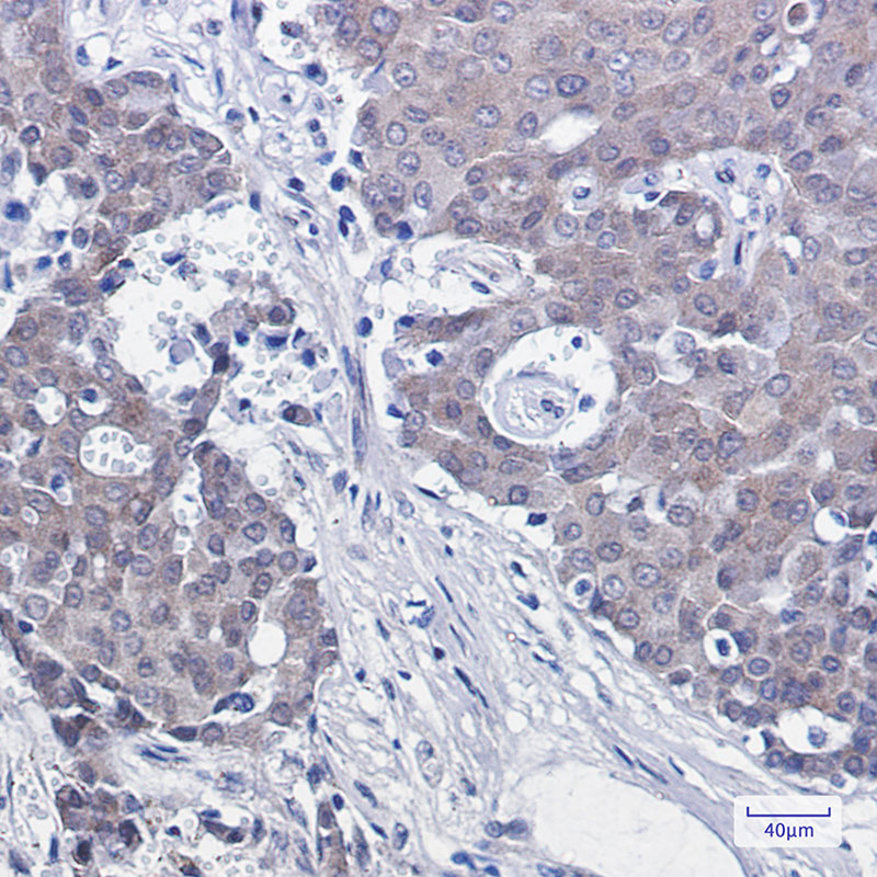 NEDD8 Rabbit mAb ABZ2082