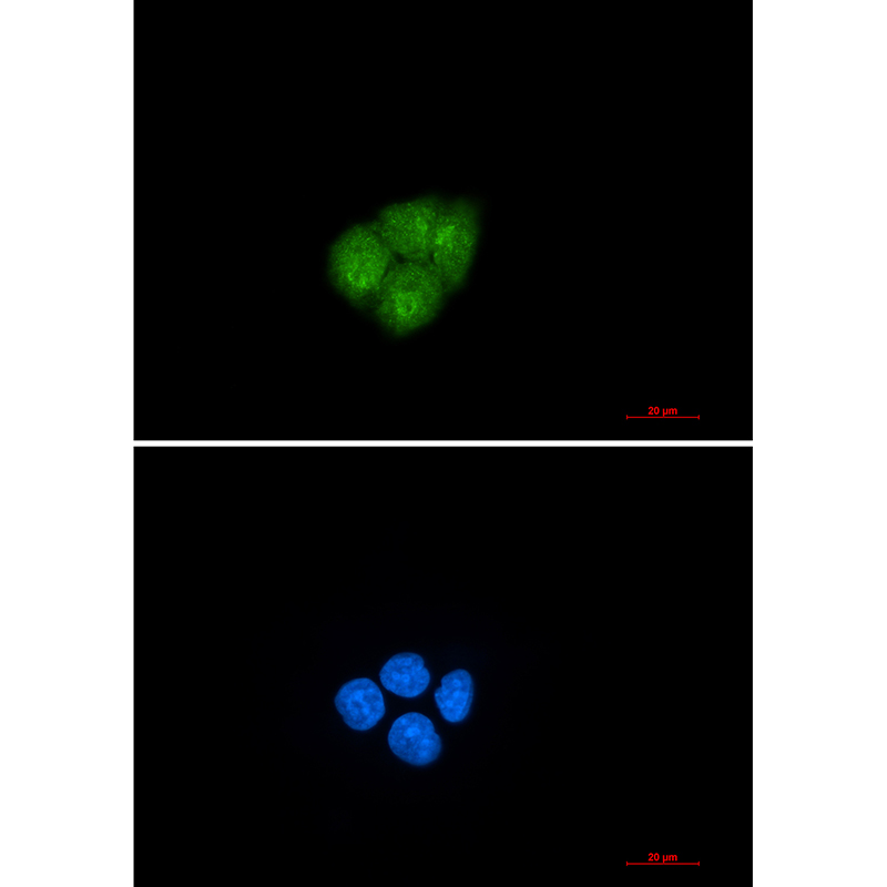 Smad2 Rabbit mAb ABZ2083