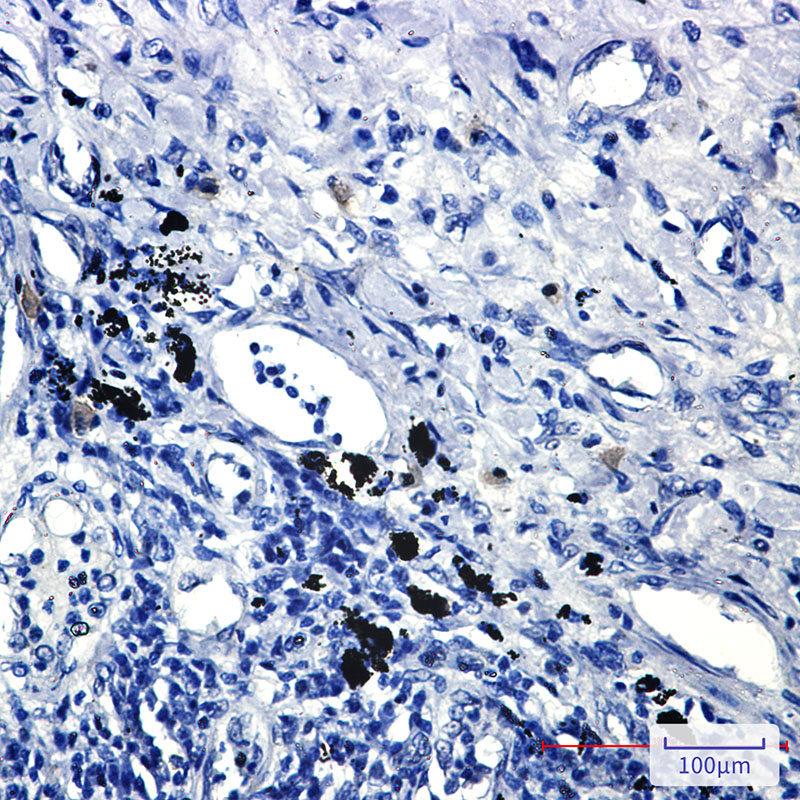 Smad2 Rabbit mAb ABZ2083