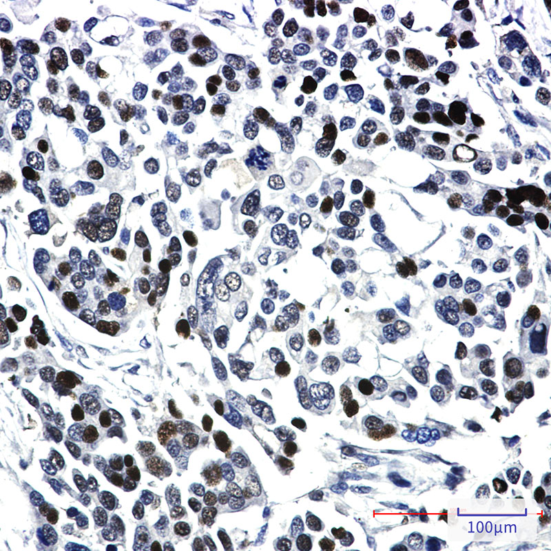 KAT13A/SRC1 Rabbit mAb ABZ2084