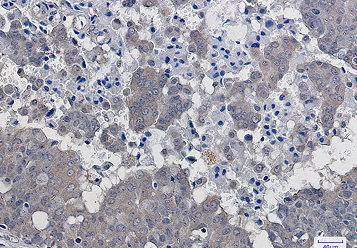 IKB beta Rabbit mAb ABZ2089