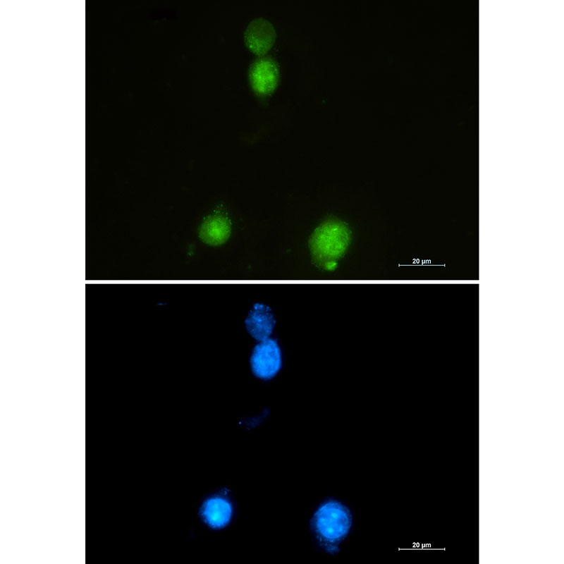 SAFB1 Rabbit mAb ABZ2092