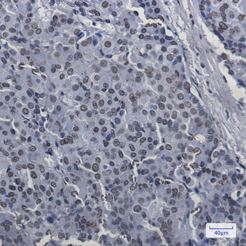 SAFB1 Rabbit mAb ABZ2092