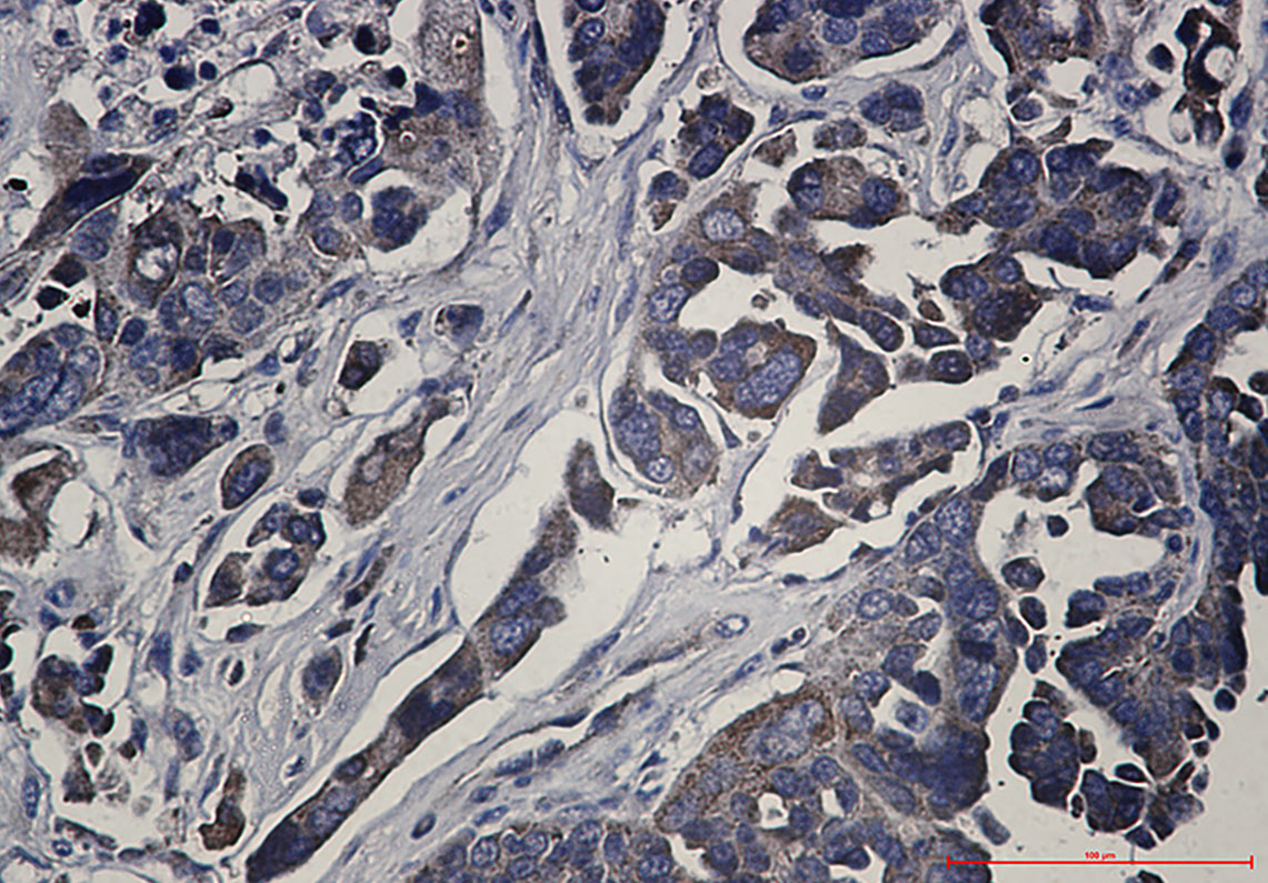 RSK1 p90 Rabbit mAb ABZ2093