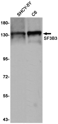 SF3B3 Rabbit mAb ABZ2094