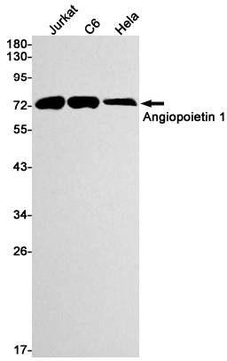 ANGPT1 Rabbit mAb ABZ2095