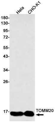 TOMM20 Rabbit mAb ABZ2096
