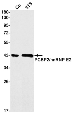 PCBP2/hnRNP E2 Rabbit mAb ABZ2097