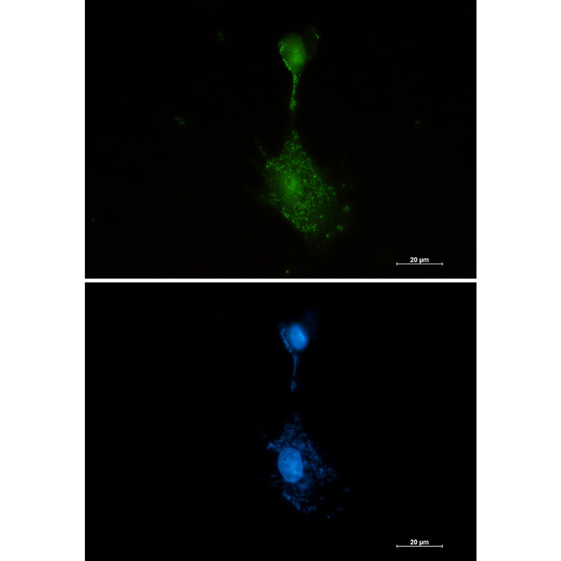 RSK3 Rabbit mAb ABZ2098