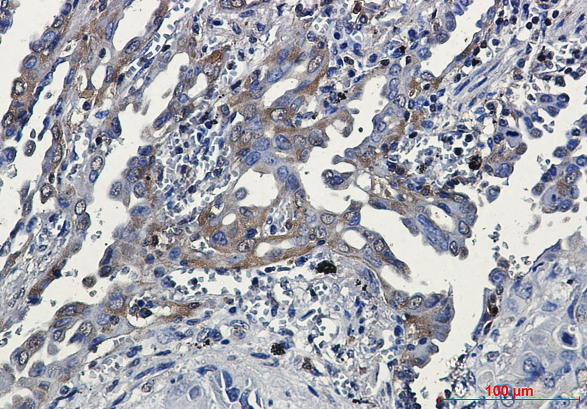 RSK3 Rabbit mAb ABZ2098