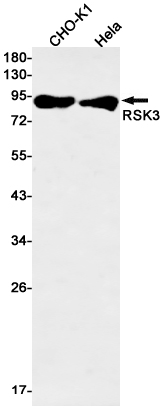 RSK3 Rabbit mAb ABZ2098