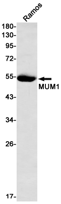 IRF4 Rabbit mAb ABZ2100