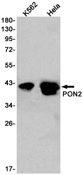 PON2 Rabbit mAb ABZ2104