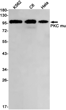 PKC mu/PKD Rabbit mAb ABZ2105