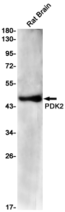 PDK2 Rabbit mAb ABZ2107