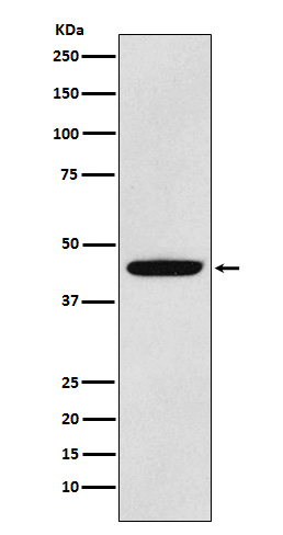 PDK1 Rabbit mAb ABZ2108
