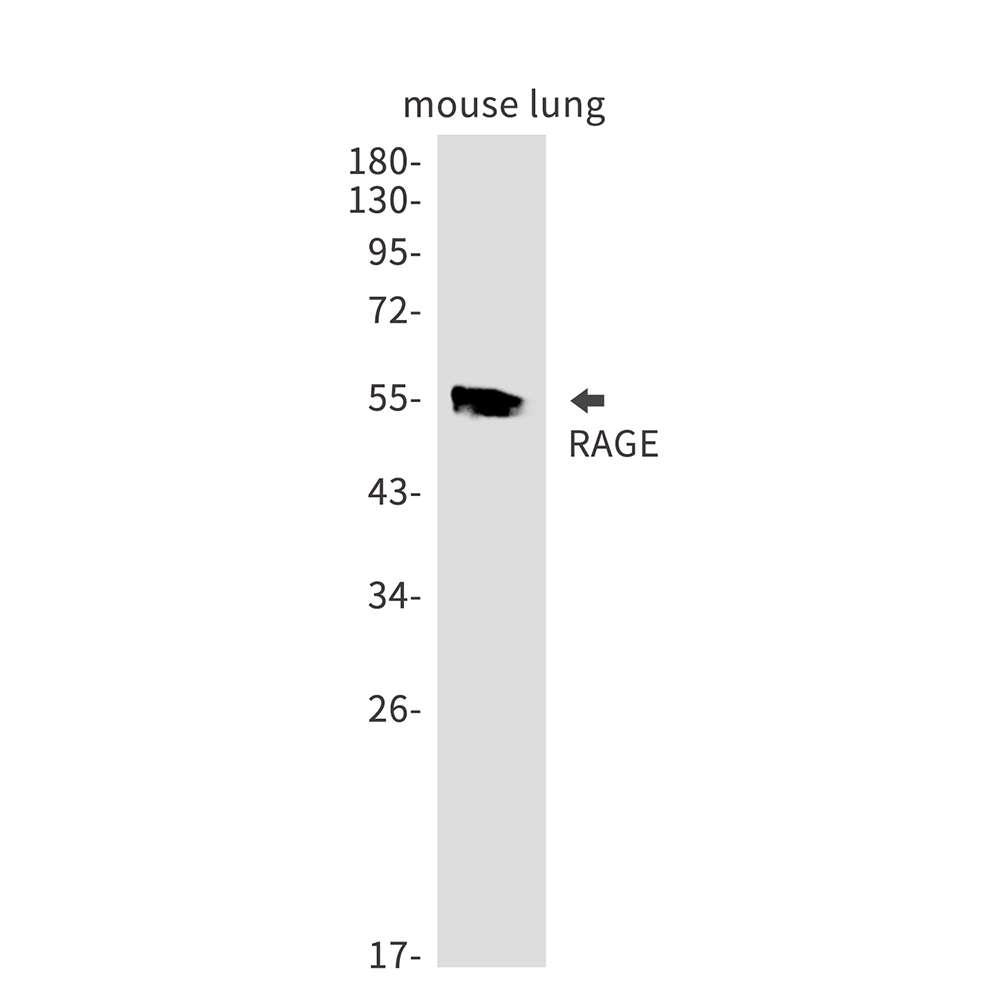 RAGE Rabbit mAb ABZ2109