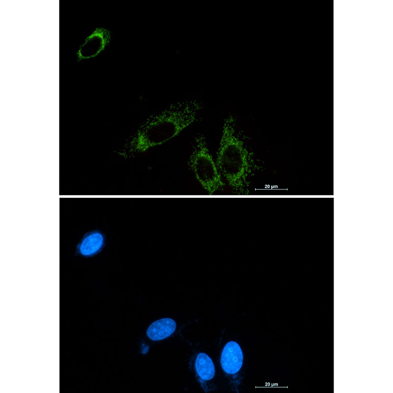 P2Y6 Rabbit mAb ABZ2111