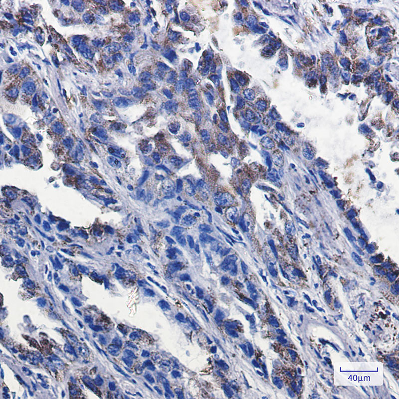 P2Y6 Rabbit mAb ABZ2111