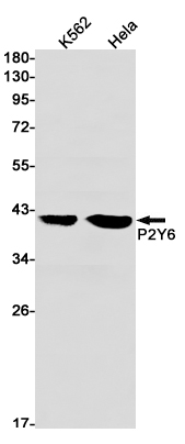 P2Y6 Rabbit mAb ABZ2111