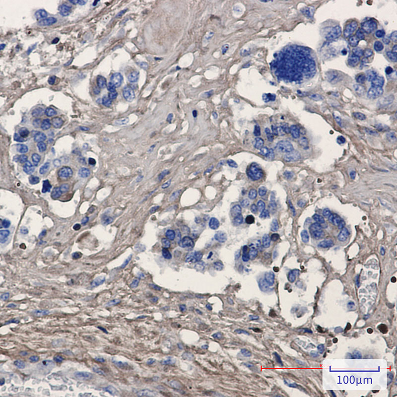 Periostin Rabbit mAb ABZ2113