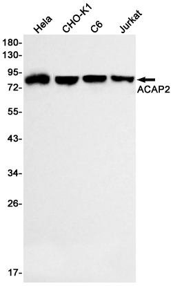 ACAP2 Rabbit mAb ABZ2114