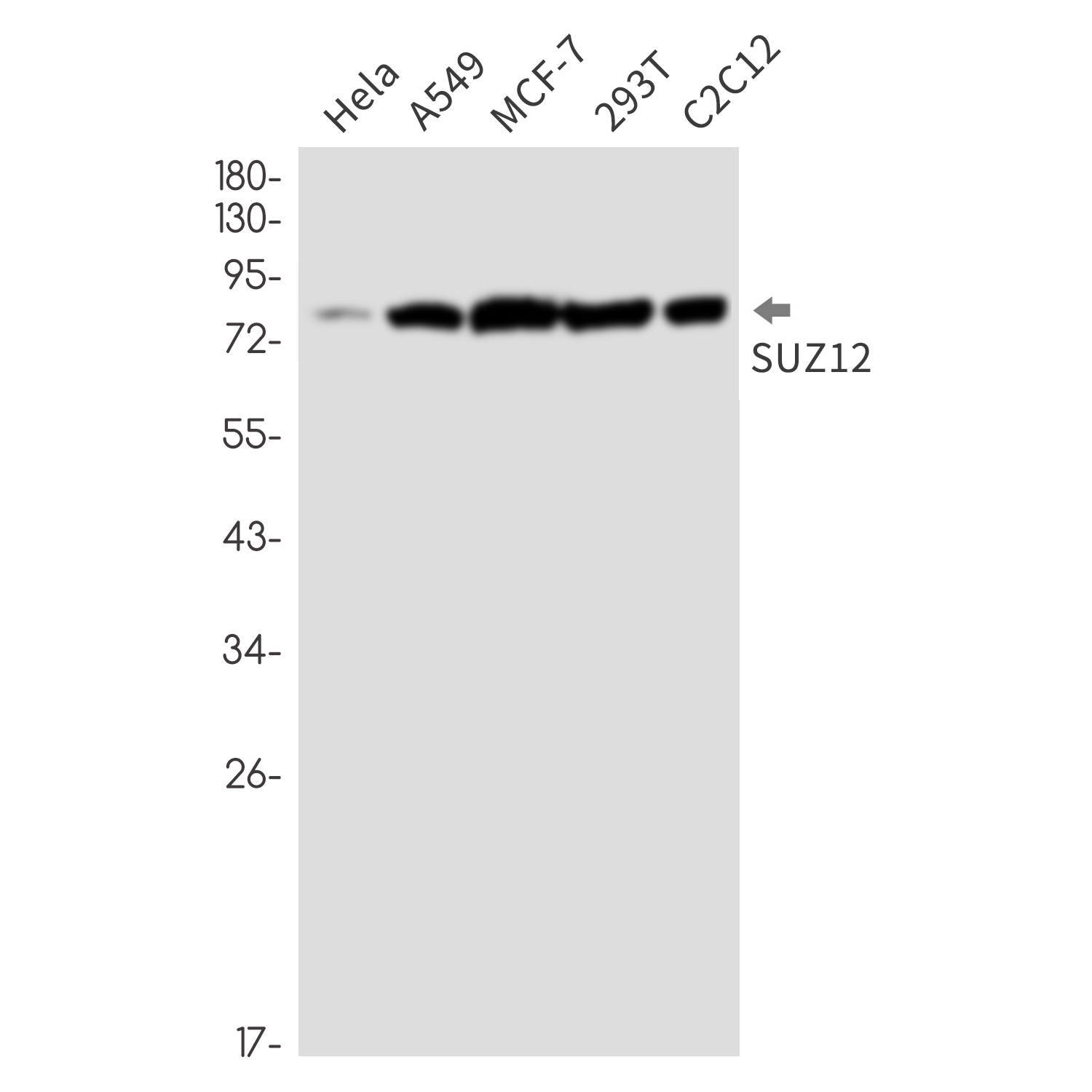 SUZ12 Rabbit mAb ABZ2115