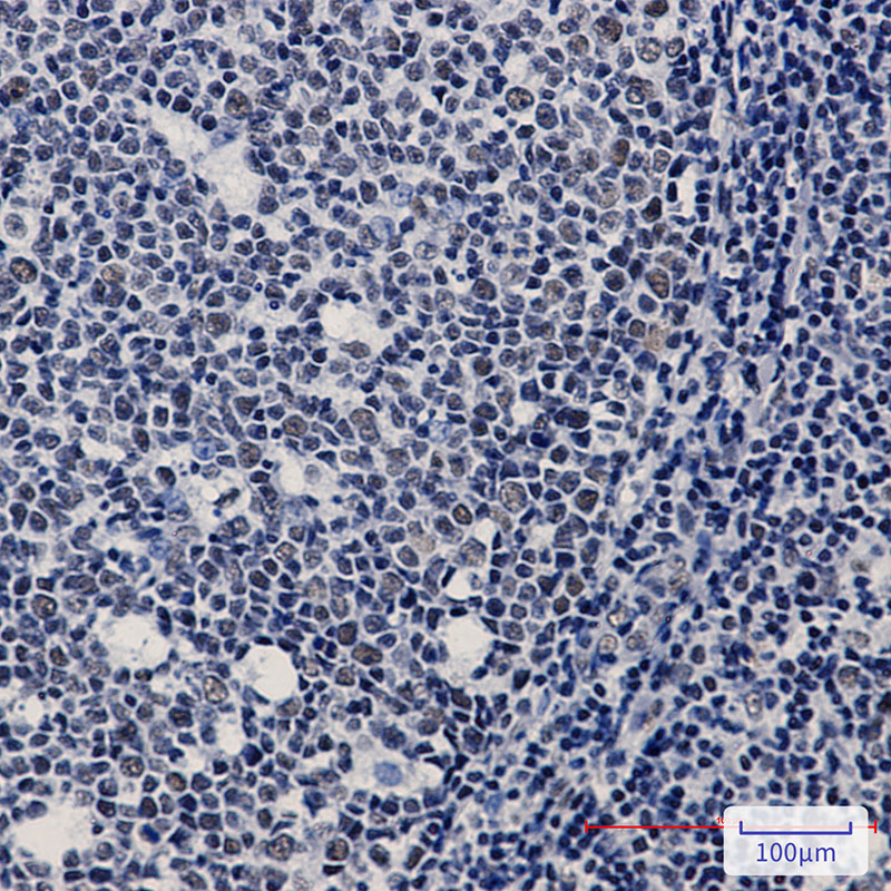 WTAP Rabbit mAb ABZ2116
