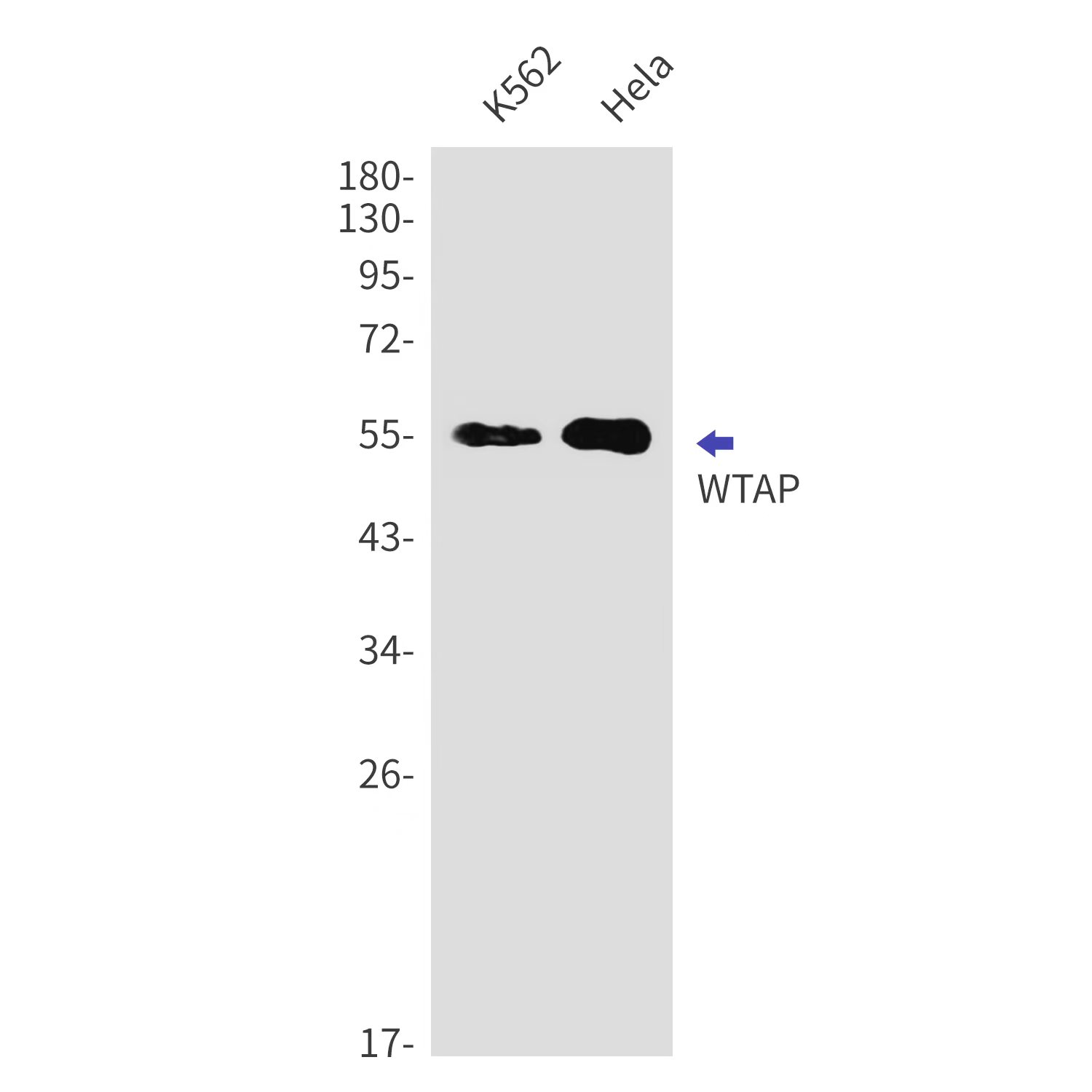WTAP Rabbit mAb ABZ2116