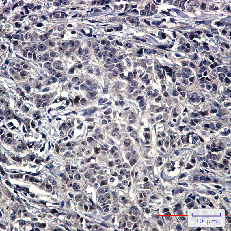 NOLC1 Rabbit mAb ABZ2117
