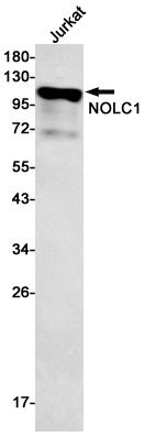 NOLC1 Rabbit mAb ABZ2117