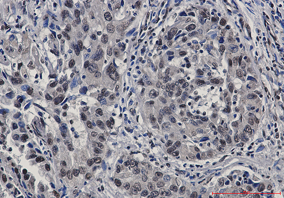 STAT4 Rabbit mAb ABZ2118