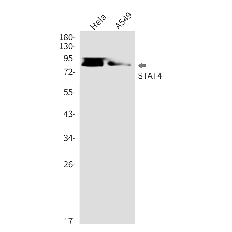 STAT4 Rabbit mAb ABZ2118