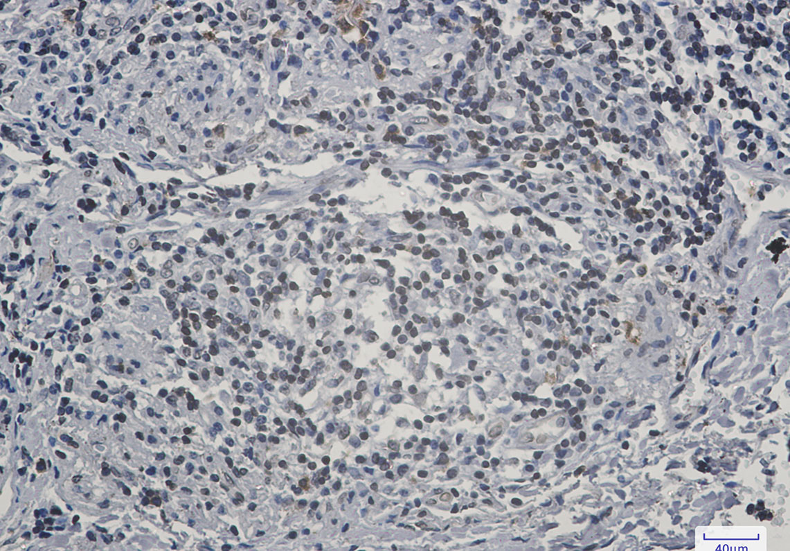 Lamin B Receptor Rabbit mAb ABZ2120