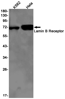 Lamin B Receptor Rabbit mAb ABZ2120