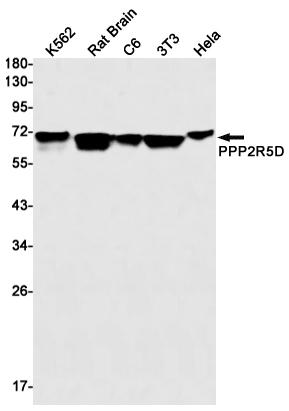 PPP2R5D Rabbit mAb ABZ2121