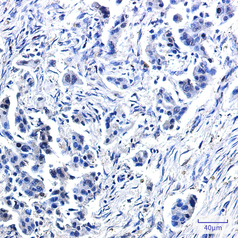 USP10 Rabbit mAb ABZ2122