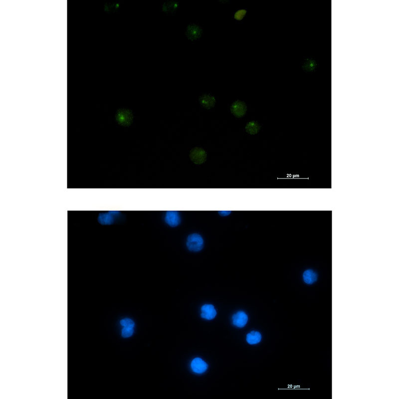 PSF1 Rabbit mAb ABZ2123