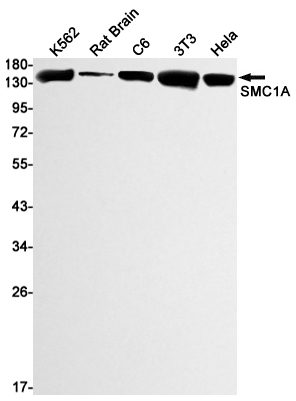 SMC1A Rabbit mAb ABZ2124