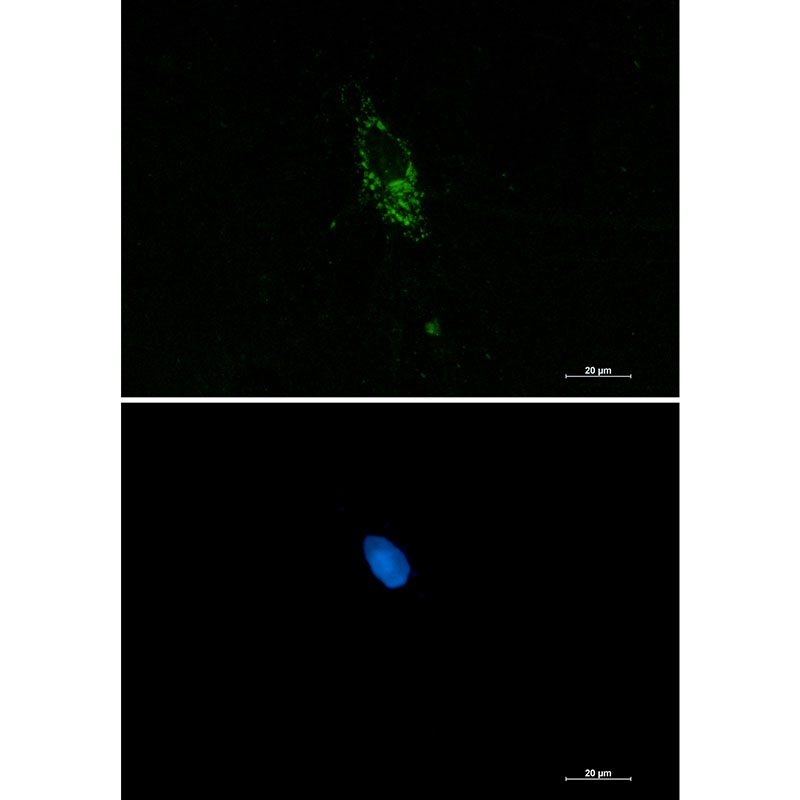 Pumilio 1 Rabbit mAb ABZ2125