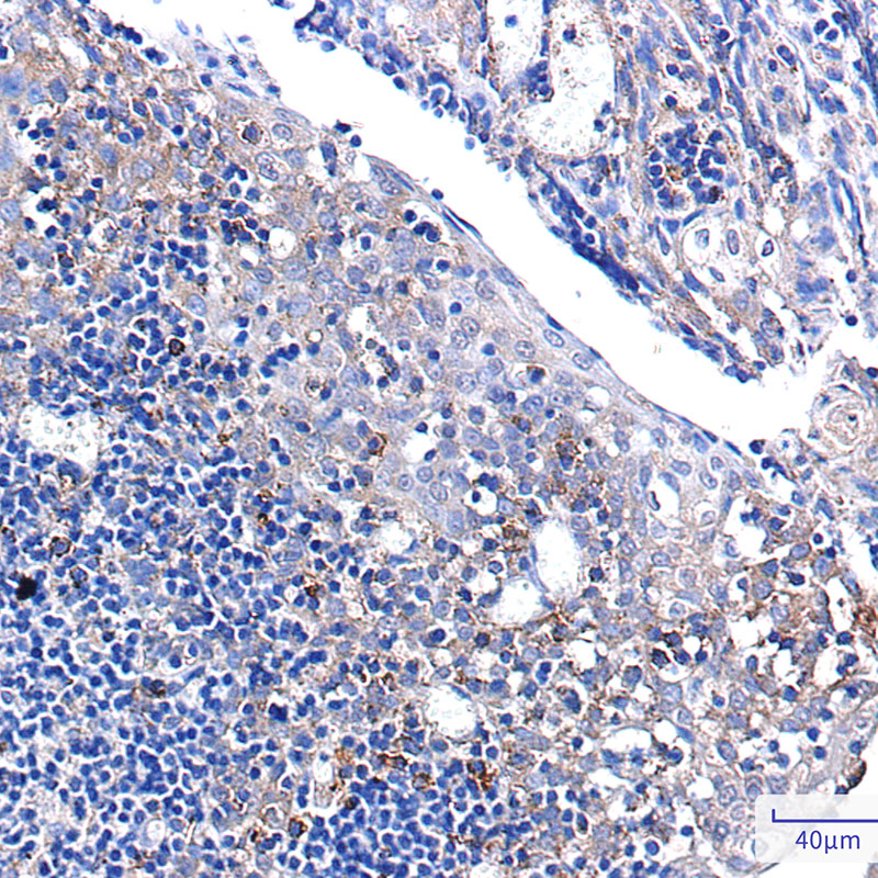 Pumilio 1 Rabbit mAb ABZ2125