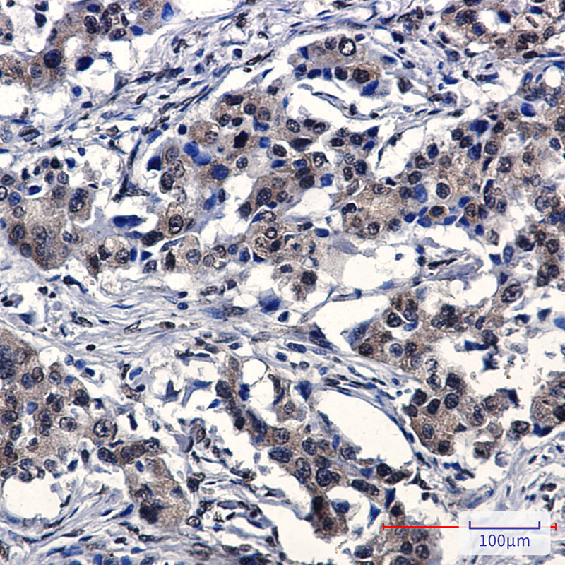 IRF3 Rabbit mAb ABZ2126